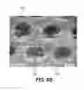 Fig. 10 - Absorbent sheet of cellulosic fibers having an upper side and a lower side with connecting regions forming a network interconnecting hollow domed regions