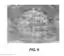 Fig. 18 - Absorbent sheet of cellulosic fibers having an upper side and a lower side with connecting regions forming a network interconnecting hollow domed regions