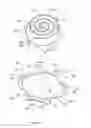 Fig. 05 - Holding plate for piloted scroll compressor