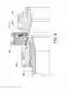 Fig. 09 - Synchronising device