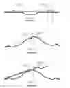 Fig. 03 - Lashing support spacer tie