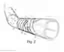 Fig. 03 - Anisotropic pipe liner