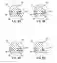 Fig. 16 - Compression fitting with torque nut