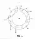 Fig. 07 - Lugged wafer alignment ring