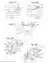 Fig. 16 - Method, a system and devices for processing at least one substance in a dried, fragmented, fluidized end product