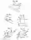 Fig. 17 - Method, a system and devices for processing at least one substance in a dried, fragmented, fluidized end product