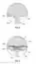 Fig. 07 - CRUCIBLES FOR MELTING MATERIAL AND METHODS OF TRANSFERRING MATERIAL THEREFROM