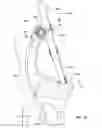 Fig. 08 - Adjustable limb systems for archery bows