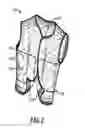 Fig. 03 - Impact marking garment