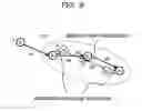 Fig. 10 - Analysis method and analyzing device