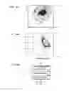 Fig. 15 - Blood analyzer and blood analyzing method