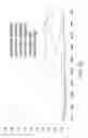 Fig. 04 - Compositions and methods for the diagnosis of rheumatoid arthritis