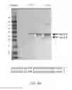 Fig. 05 - Compositions and methods for the diagnosis of rheumatoid arthritis