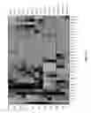 Fig. 19 - METHODS FOR DIAGNOSIS OF CELIAC DISEASE