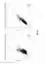 Fig. 21 - CARDIOVASCULAR RISK EVENT PREDICTION AND USES THEREOF
