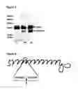 Fig. 03 - CHONDROADHERIN FRAGMENTS AS INDICATORS OF INTERVERTEBRAL DISC DEGENERATION