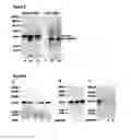 Fig. 05 - CHONDROADHERIN FRAGMENTS AS INDICATORS OF INTERVERTEBRAL DISC DEGENERATION
