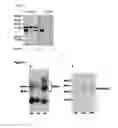 Fig. 06 - CHONDROADHERIN FRAGMENTS AS INDICATORS OF INTERVERTEBRAL DISC DEGENERATION