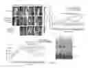 Fig. 10 - Methods for diagnosis and treatment of amyotrophic lateral sclerosis based on an increased level of interaction between TDP-43 polypeptide and NF-KB P65 polypeptide