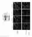 Fig. 13 - Methods for diagnosis and treatment of amyotrophic lateral sclerosis based on an increased level of interaction between TDP-43 polypeptide and NF-KB P65 polypeptide