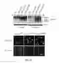 Fig. 29 - Methods for diagnosis and treatment of amyotrophic lateral sclerosis based on an increased level of interaction between TDP-43 polypeptide and NF-KB P65 polypeptide