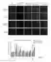 Fig. 37 - Methods for diagnosis and treatment of amyotrophic lateral sclerosis based on an increased level of interaction between TDP-43 polypeptide and NF-KB P65 polypeptide