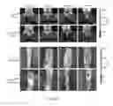 Fig. 38 - Methods for diagnosis and treatment of amyotrophic lateral sclerosis based on an increased level of interaction between TDP-43 polypeptide and NF-KB P65 polypeptide