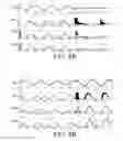 Fig. 09 - Method and device for monitoring and estimating a periodic voltage of a medium voltage electrical circuit