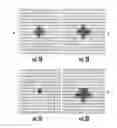 Fig. 03 - Device for cancellation of large magnetic susceptibility artifacts in magnetic resonance imaging of patients with pacemakers and implantable cardiac defibrillators