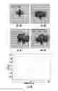 Fig. 05 - Device for cancellation of large magnetic susceptibility artifacts in magnetic resonance imaging of patients with pacemakers and implantable cardiac defibrillators
