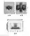Fig. 06 - Device for cancellation of large magnetic susceptibility artifacts in magnetic resonance imaging of patients with pacemakers and implantable cardiac defibrillators
