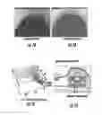 Fig. 08 - Device for cancellation of large magnetic susceptibility artifacts in magnetic resonance imaging of patients with pacemakers and implantable cardiac defibrillators