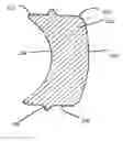 Fig. 01 - Method of locally thickening an ophthalmic lens