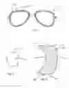 Fig. 03 - Method of locally thickening an ophthalmic lens