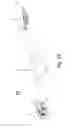 Fig. 10 - Dynamic rotation monopod