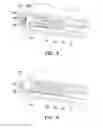 Fig. 08 - Electronic device