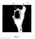 Fig. 05 - Hand-gesture-based region of interest localization