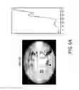 Fig. 08 - System and method for seat occupancy detection from ceiling mounted camera using robust adaptive threshold criteria