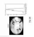 Fig. 09 - System and method for seat occupancy detection from ceiling mounted camera using robust adaptive threshold criteria