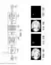 Fig. 15 - System and method for seat occupancy detection from ceiling mounted camera using robust adaptive threshold criteria