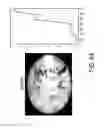 Fig. 08 - System and method for detecting settle down time using computer vision techniques