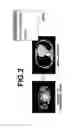Fig. 03 - Medical image storage processing apparatus, method, and medium