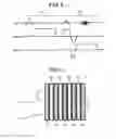 Fig. 04 - Magnetic resonance imaging apparatus