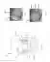 Fig. 09 - Methods and systems for corneal topography, blink detection and laser eye surgery