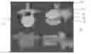 Fig. 01 - Kinematic analysis based on MRI bone marrow signals
