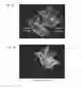 Fig. 03 - Kinematic analysis based on MRI bone marrow signals