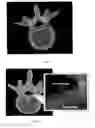 Fig. 04 - Kinematic analysis based on MRI bone marrow signals