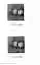 Fig. 10 - Medical diagnostic apparatus, medical image processing apparatus and medical image processing method