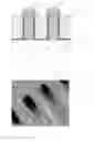 Fig. 03 - Method for forming control gate salicide