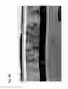 Fig. 17 - Thin-film piezoelectric material element, method of manufacturing the same, head gimbal assembly, hard disk drive, ink jet head, variable focus lens and sensor